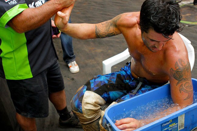 Best Arm Pump Cures - MojoMotoSport.com